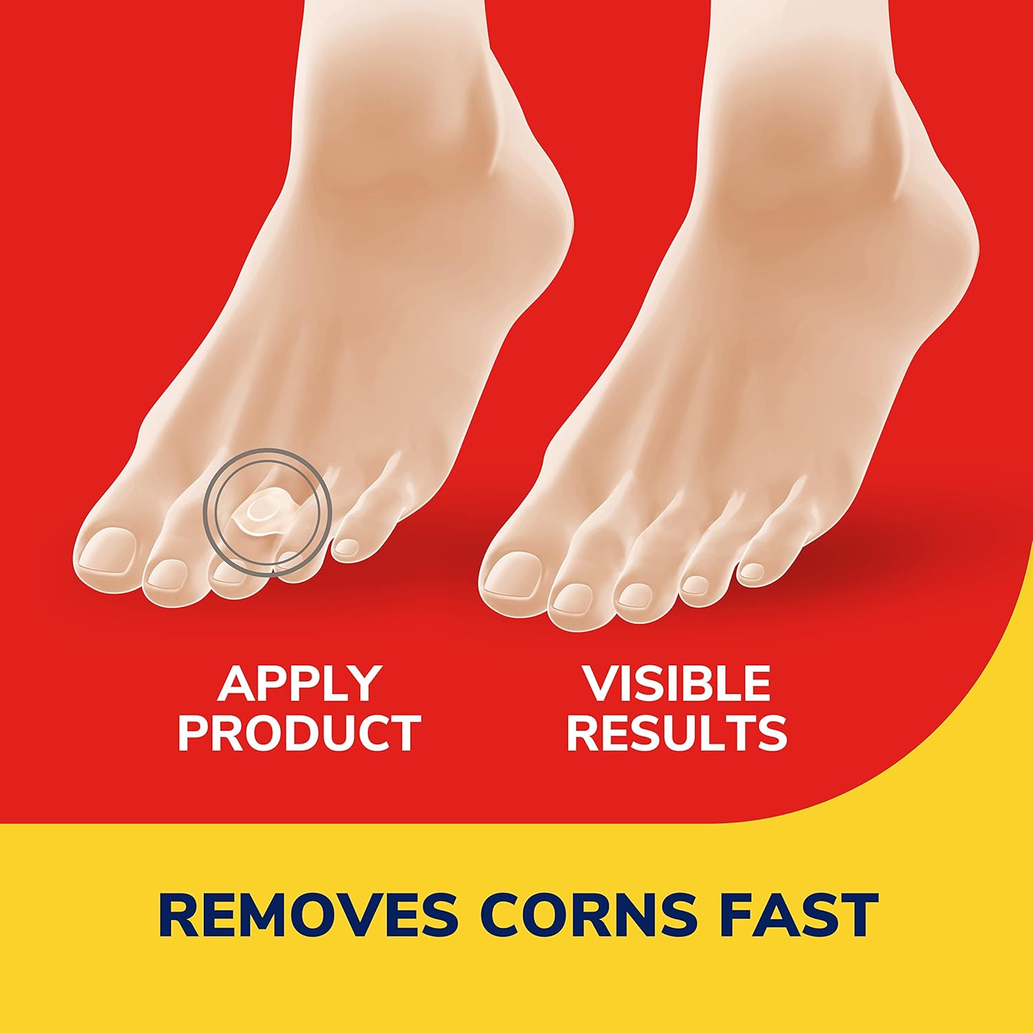 Dr. Scholl's Corn REMOVERS, 9 Ct // Removes Corns in as Few as 2 Treatments, Maximum Strength, Stays on All Day - Image 3